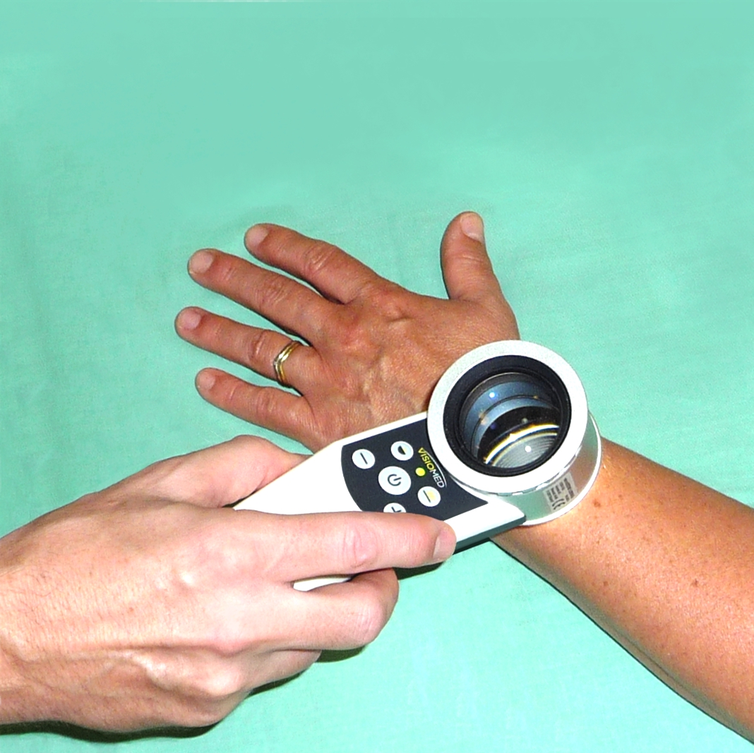 dermatoskop_quadrat